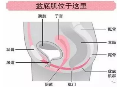 成都盆底康复 成都盆底康复