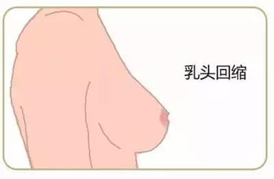 �ɶ���ͷ����